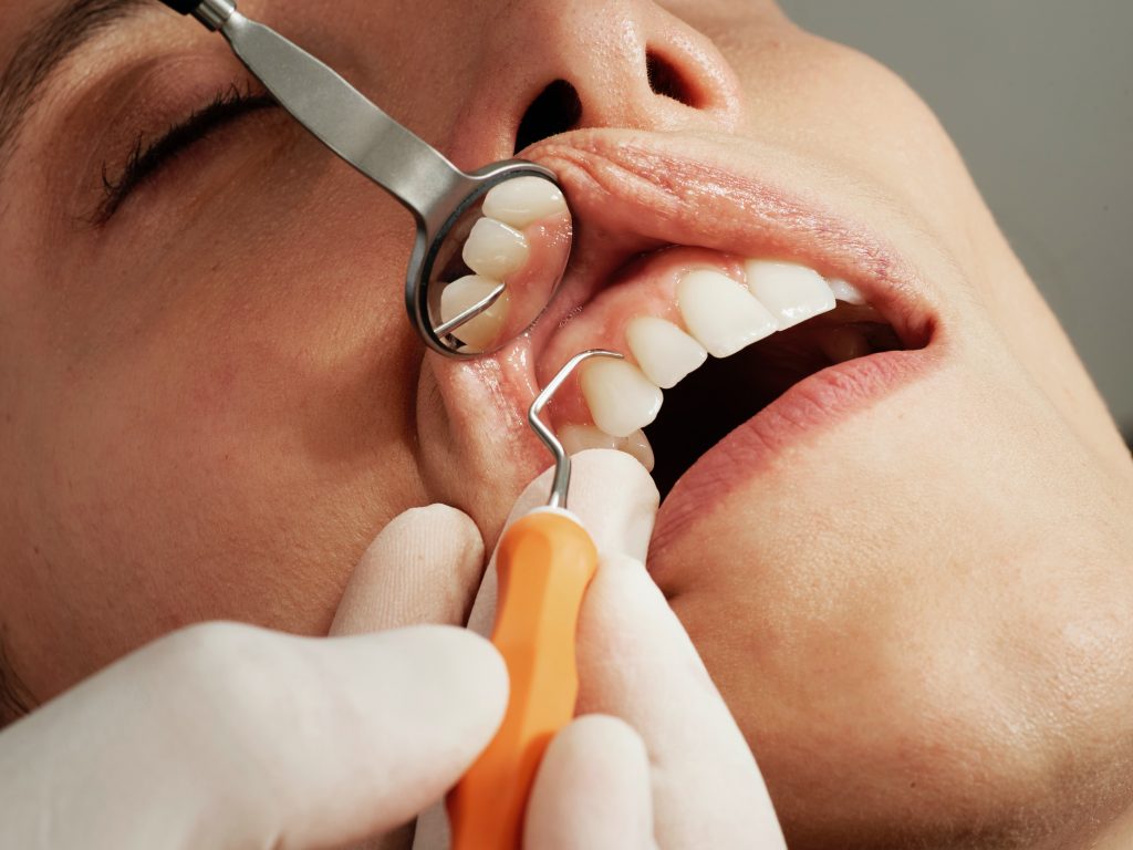 Dentist Beerwah - woman at dentist