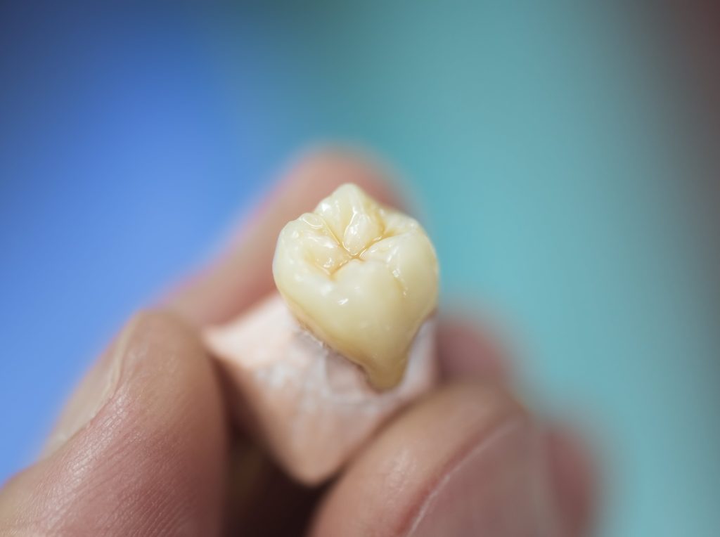 Dental crown model