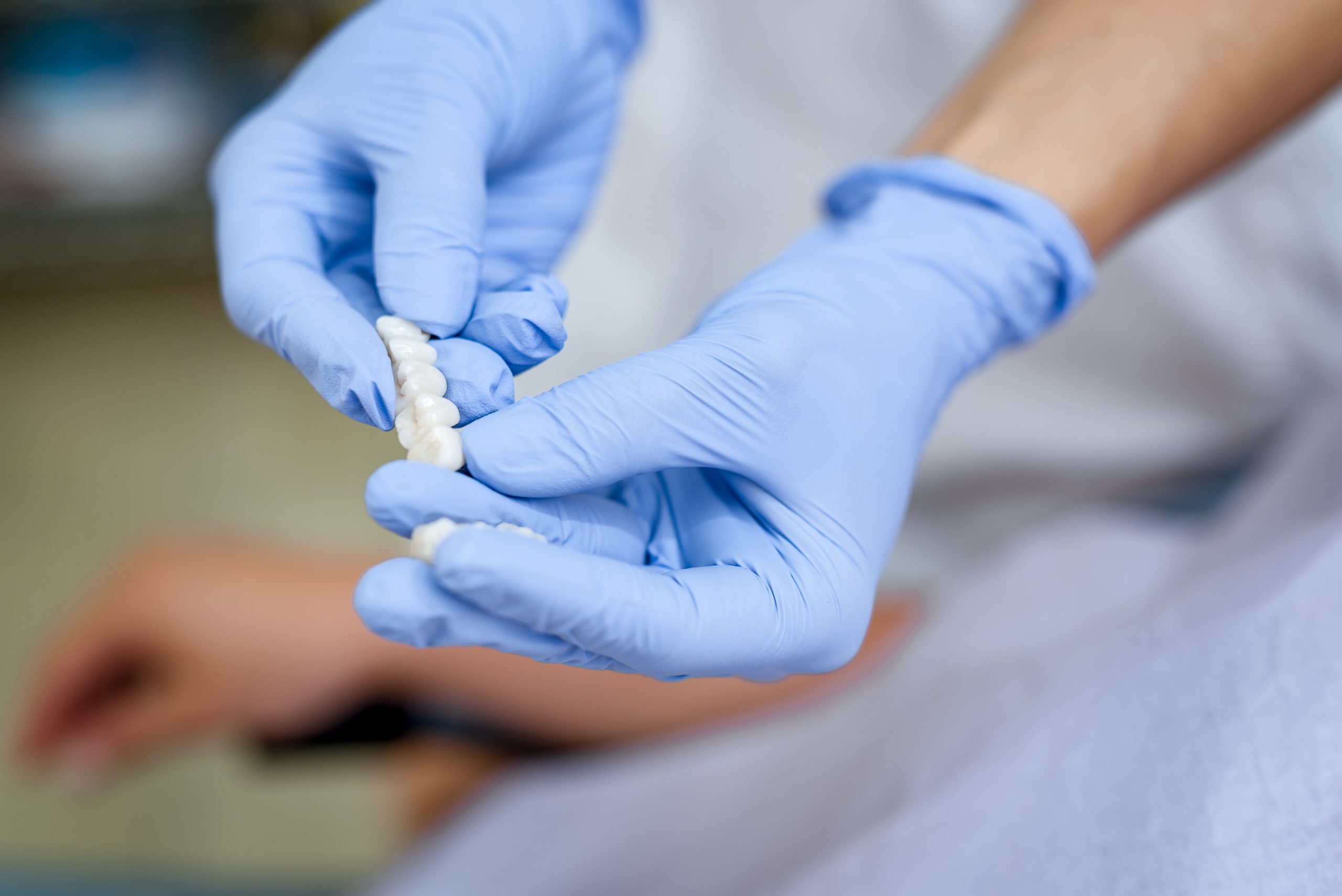 dental veneers - dentist showing model of teeth