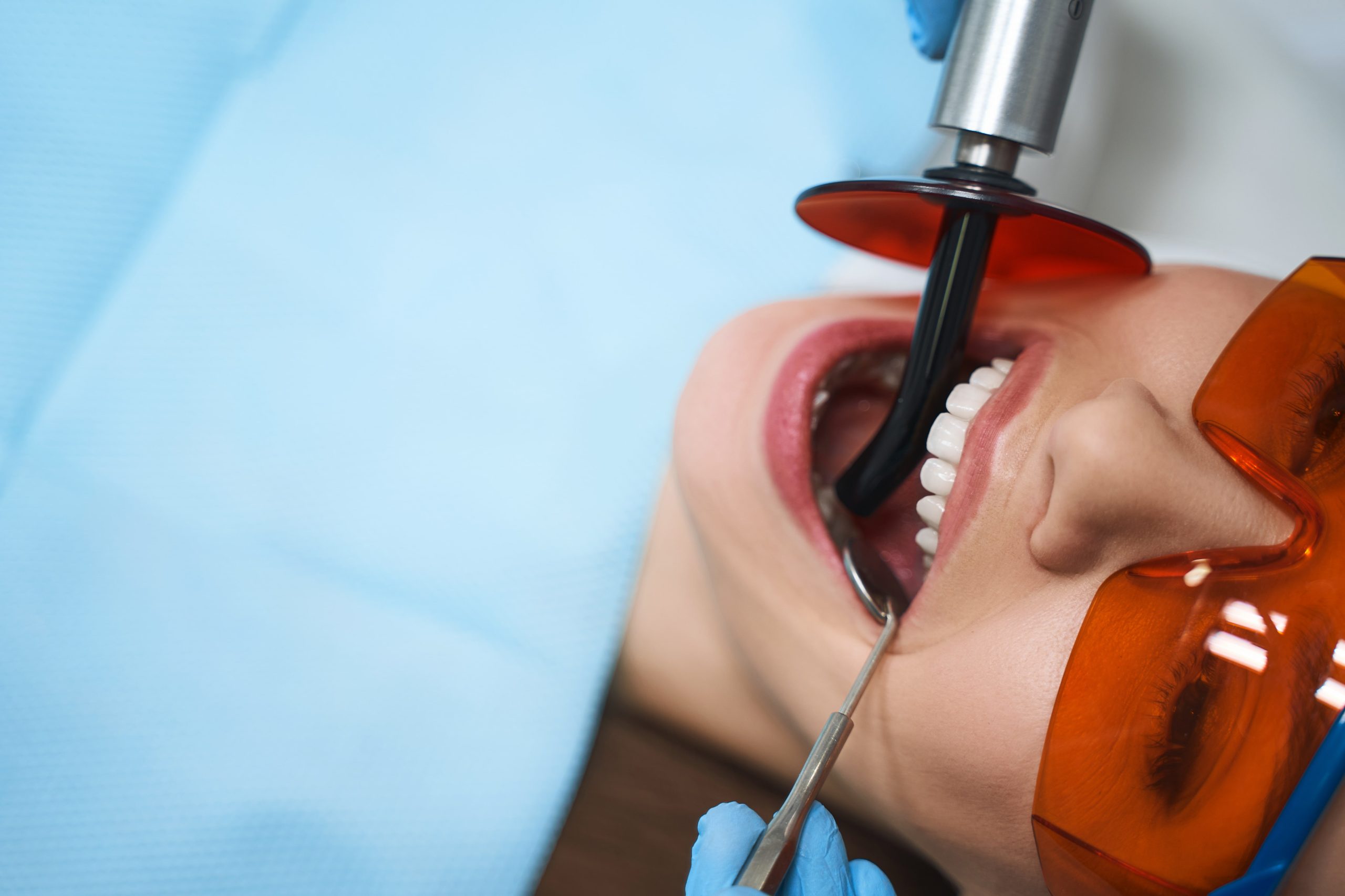 root canal therapy - closeup of womans teeth