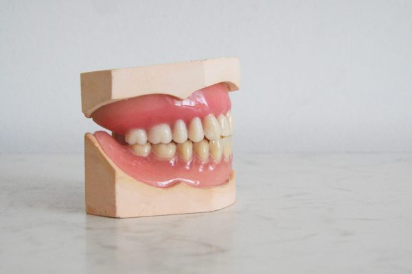 Dentist Sunshine Coast - model teeth